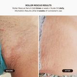 Bushbalm Roller Rescue Soother Serum