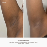 Bushbalm Bermuda Dark Spot Oil