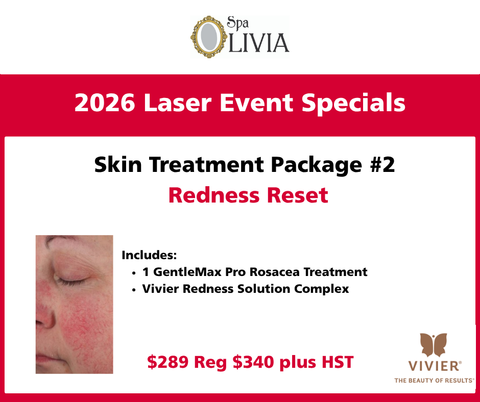 Laser event 2026  GentleMax Pro Show Special #2- Redness Reset $299 reg $340 plus HST