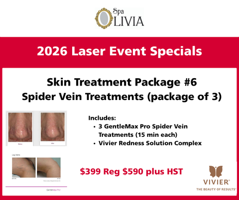 Laser event 2026  GentleMax Pro Show Special #6 -Spider Vein Treatments (package of 3)  $399 reg $590